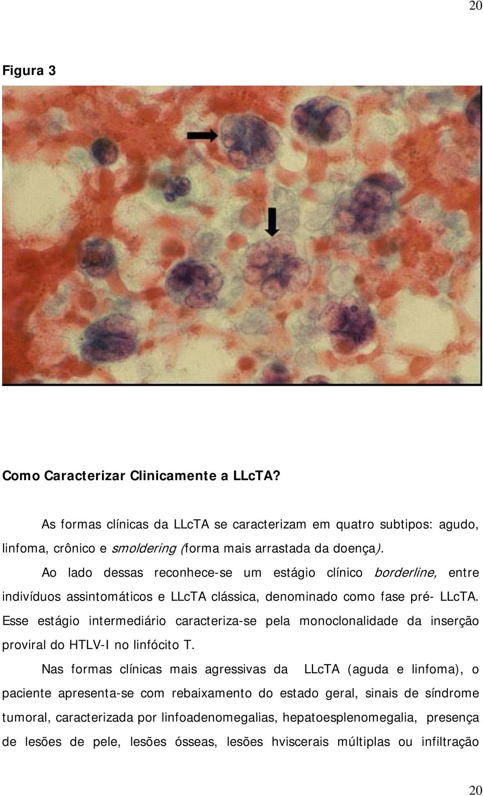 Ao lado dessas reconhece-se um estágio clínico borderline, entre indivíduos assintomáticos e LLcTA clássica, denominado como fase pré- LLcTA.