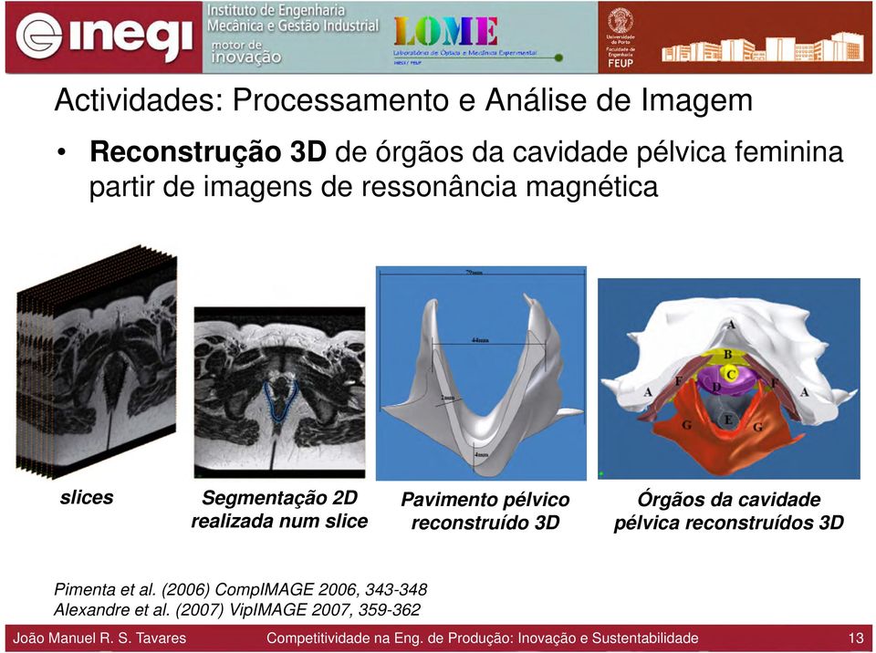 Órgãos da cavidade pélvica reconstruídos 3D Pimenta et al. (2006) CompIMAGE 2006, 343-348 Alexandre et al.