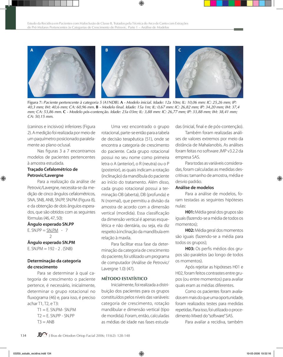 B - Modelo final. Idade: 15a 1m; IL: 0,67 mm: IC: 26,82 mm; IP: 34,20 mm; IM: 37,4 mm; CA: 53,86 mm. C - Modelo pós-contenção.