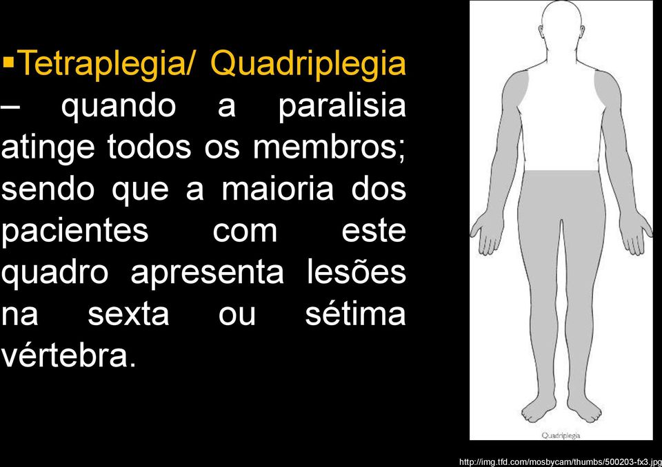 com este quadro apresenta lesões na sexta ou sétima