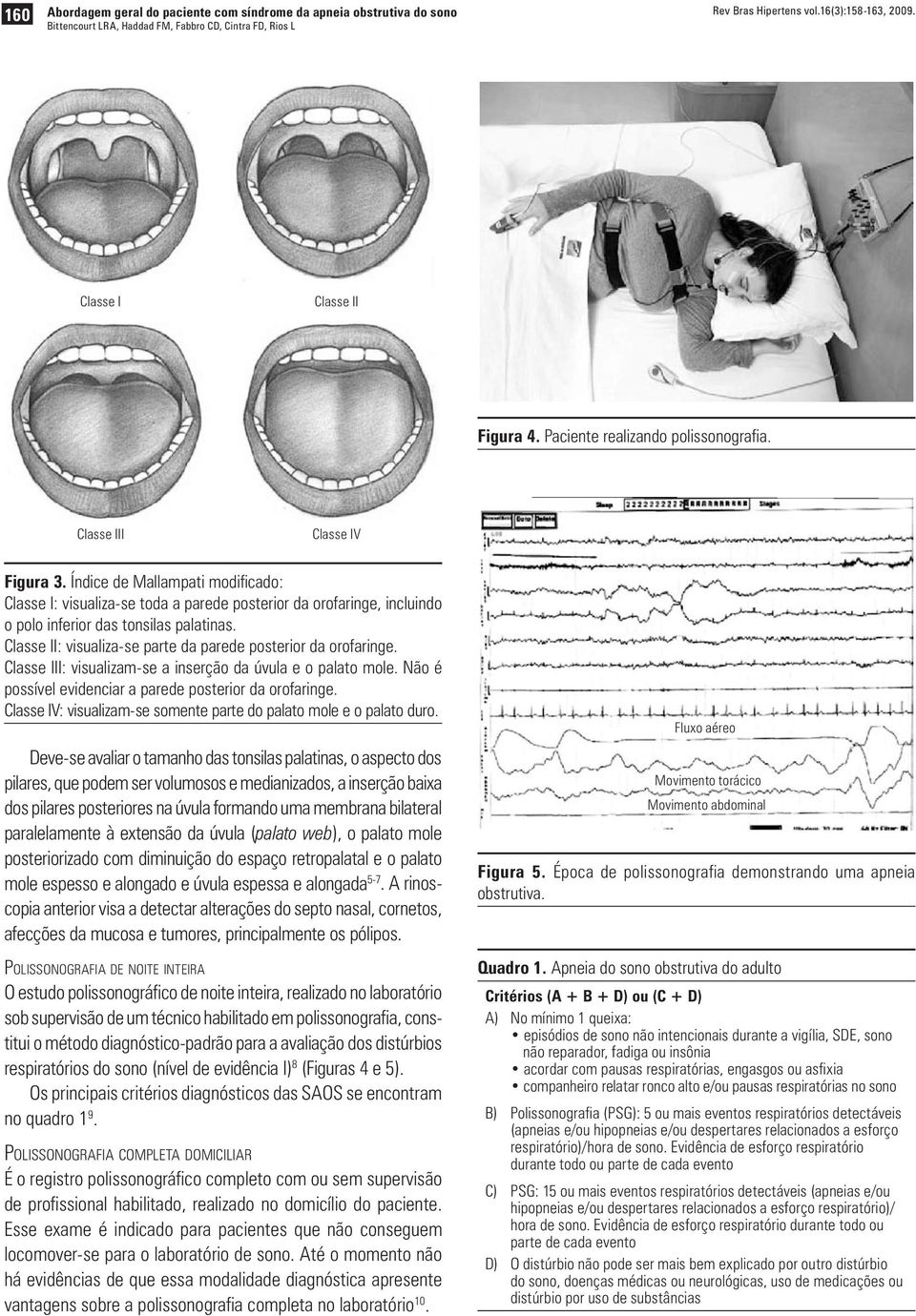 Classe II: visualiza-se parte da parede posterior da orofaringe. Classe III: visualizam-se a inserção da úvula e o palato mole. Não é possível evidenciar a parede posterior da orofaringe.