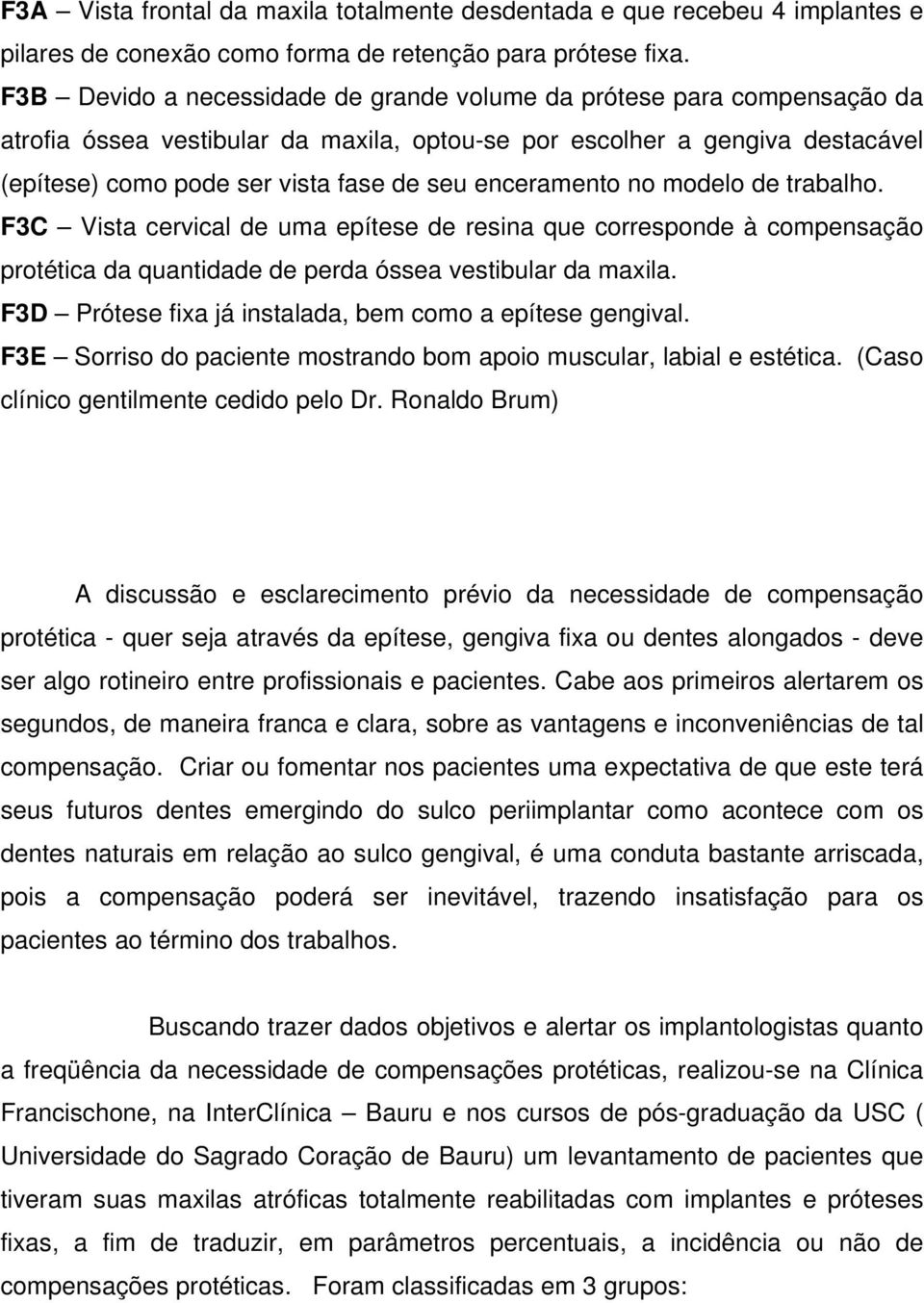 enceramento no modelo de trabalho. F3C Vista cervical de uma epítese de resina que corresponde à compensação protética da quantidade de perda óssea vestibular da maxila.