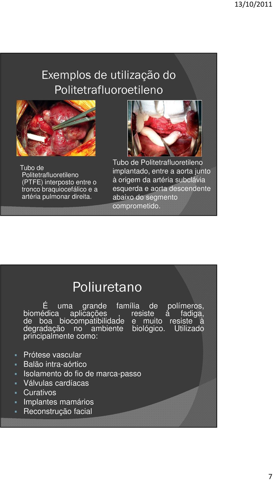 Poliuretano É uma grande família de polímeros, biomédica aplicações, resiste à fadiga, de boa biocompatibilidade e muito resiste à degradação no ambiente