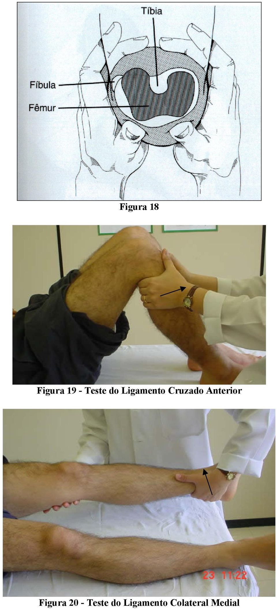 Anterior Figura 20 - Teste