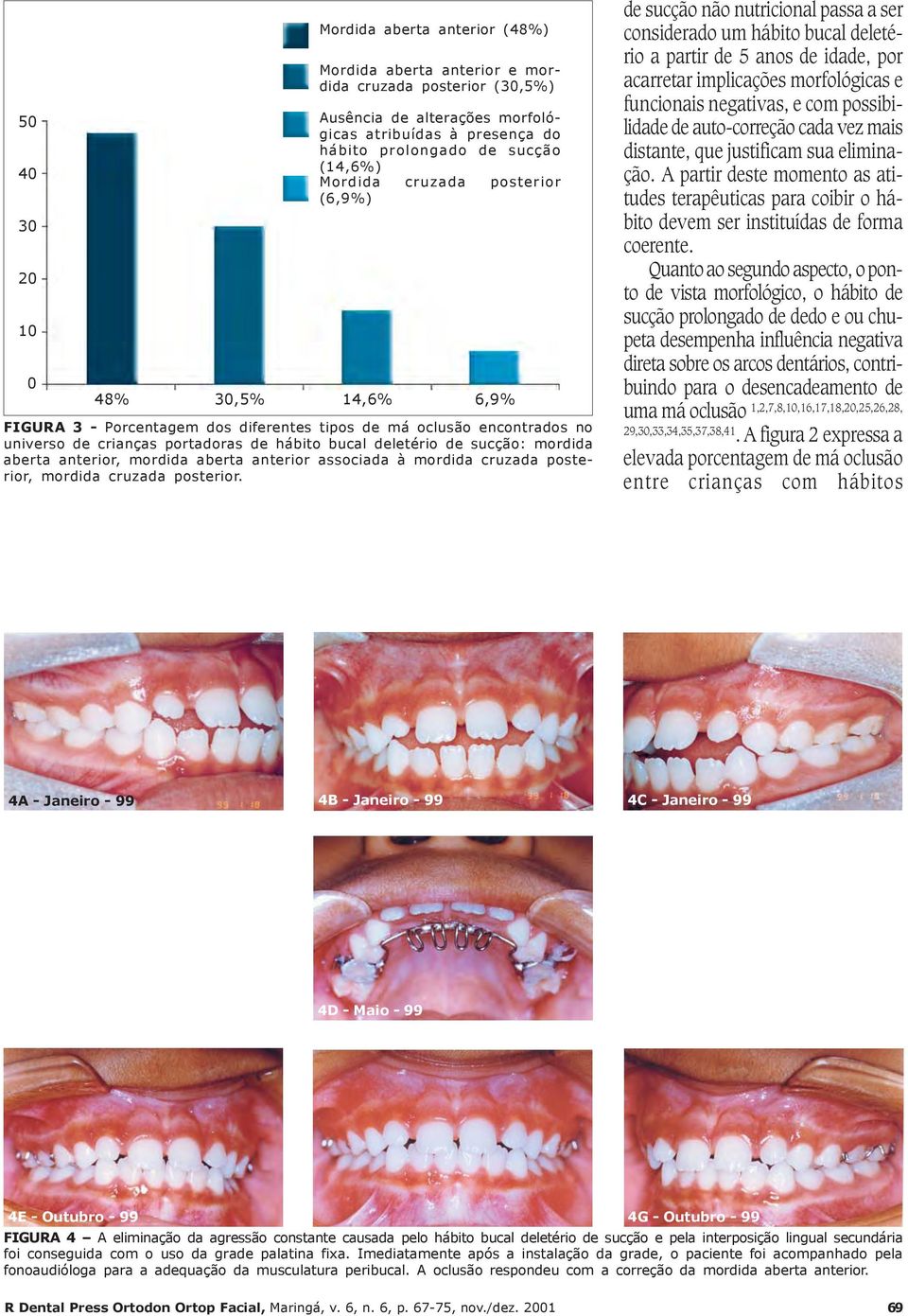 sucção: mordida aberta anterior, mordida aberta anterior associada à mordida cruzada posterior, mordida cruzada posterior.