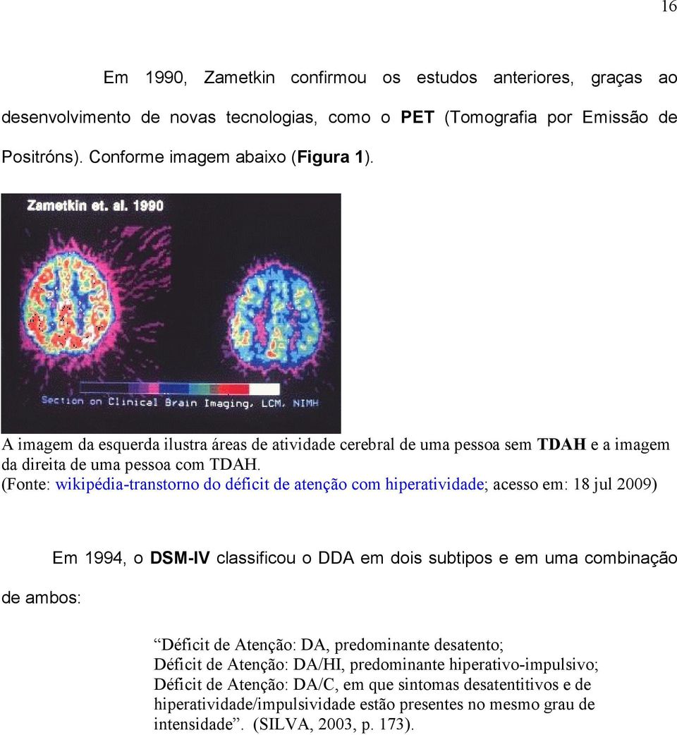 (Fonte: wikipédia-transtorno do déficit de atenção com hiperatividade; acesso em: 18 jul 2009) de ambos: Em 1994, o DSM-IV classificou o DDA em dois subtipos e em uma combinação Déficit de