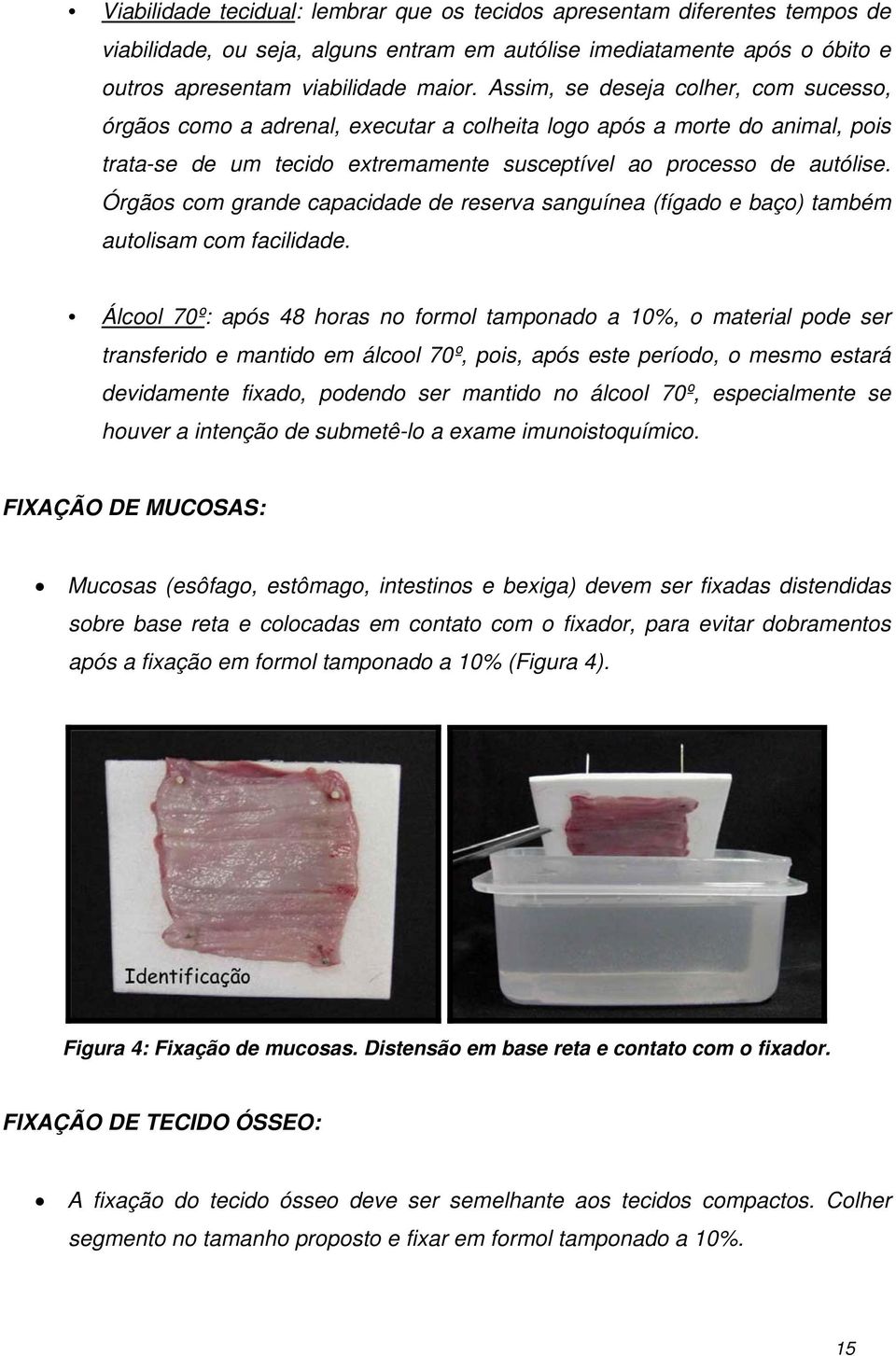 Órgãos com grande capacidade de reserva sanguínea (fígado e baço) também autolisam com facilidade.