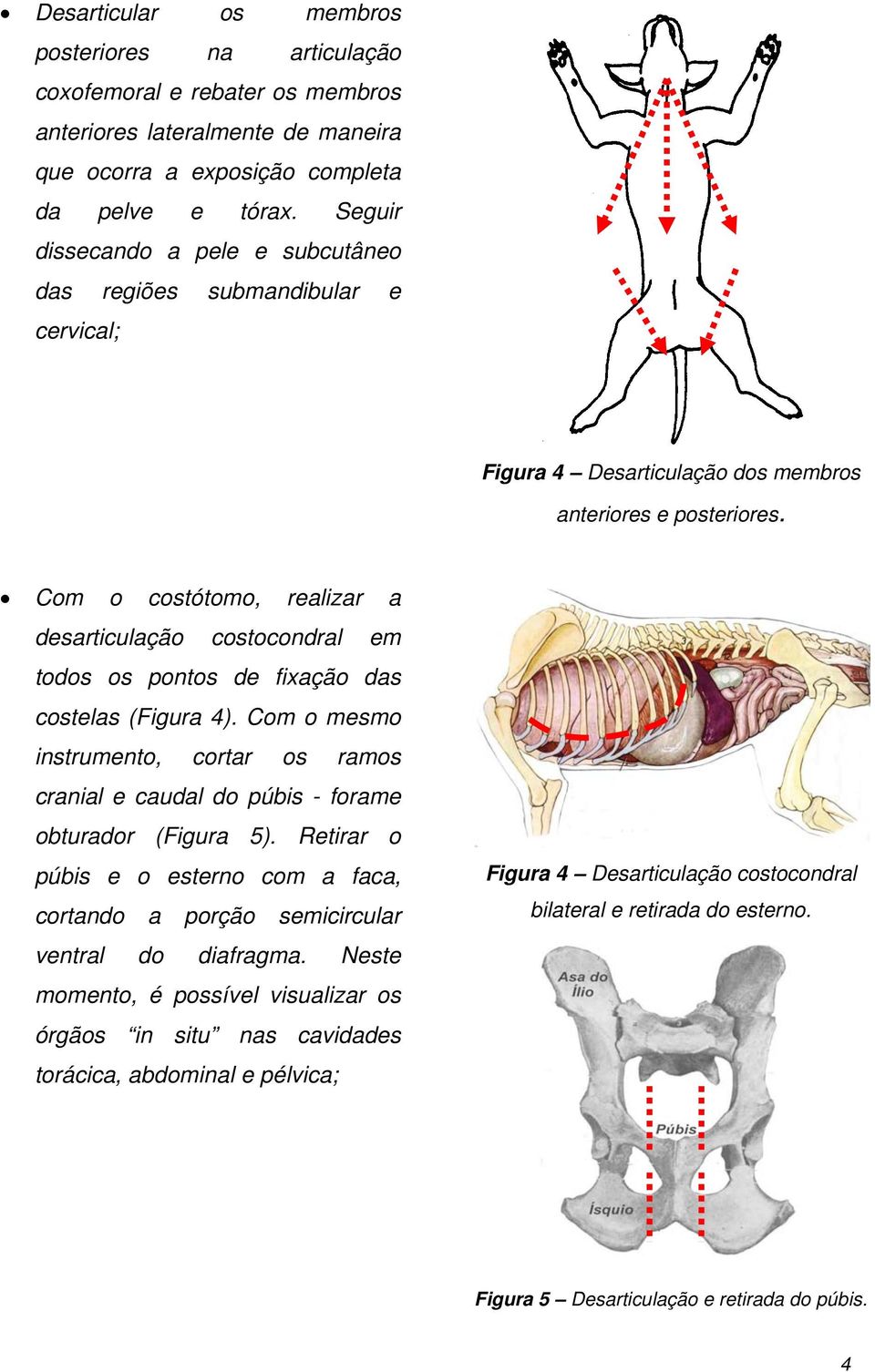 Com o costótomo, realizar a desarticulação costocondral em todos os pontos de fixação das costelas (Figura 4).