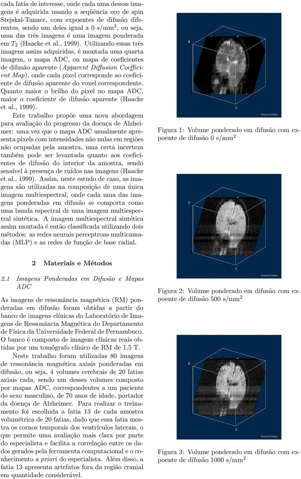 Utilizando essas três imagens assim adquiridas, é montada uma quarta imagem, o mapa ADC, ou mapa de coeficientes de difusão aparente (Apparent Diffusion Coefficient Map), onde cada pixel corresponde