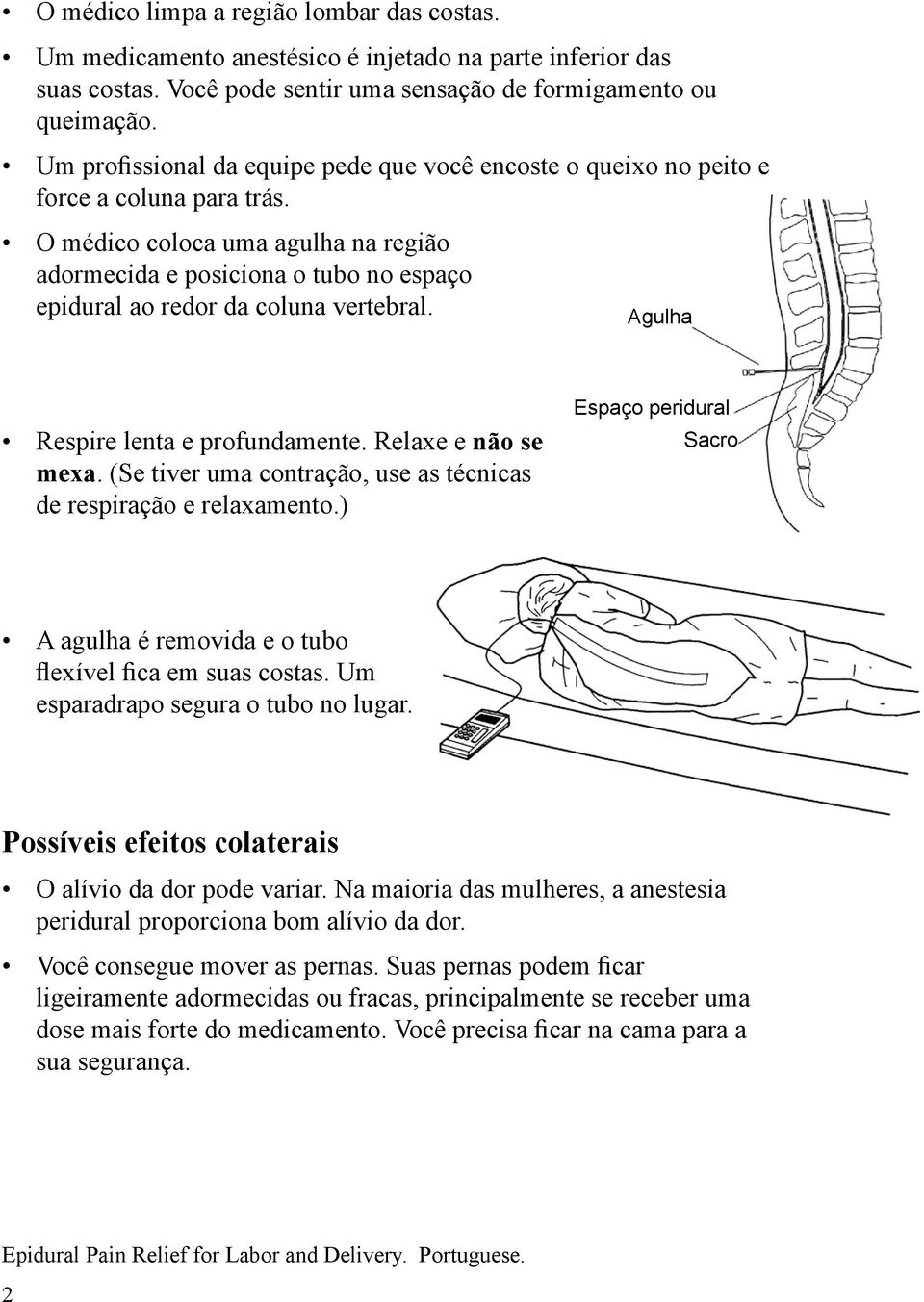 O médico coloca uma agulha na região adormecida e posiciona o tubo no espaço epidural ao redor da coluna vertebral. Agulha Respire lenta e profundamente. Relaxe e não se mexa.