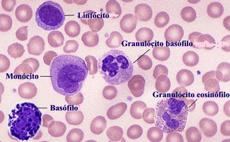 Leucocitose 10.000/mm³ de sangue Leucopenia 2.000/mm³ de sangue Leucemia de 100 mil leucócitos/mm³ de sangue Neutrófilo: - Um grande leucócito que fagocita (ingere) antígenos e outras substâncias.