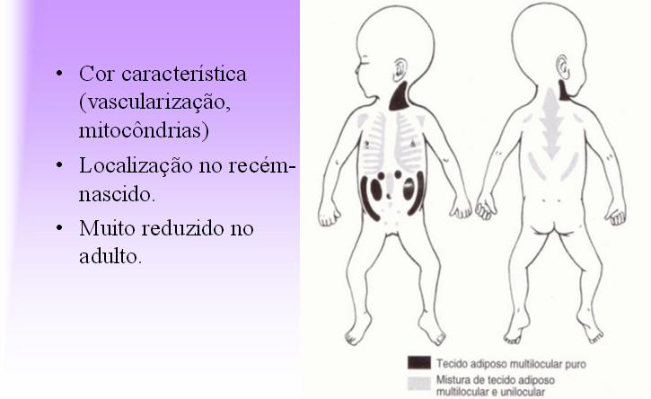 Tipos de Tecido Adiposo Tecido Adiposo Branco ou Unilocular Tecido adiposo Branco