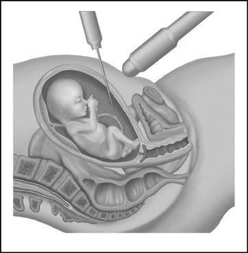 Meio de flutuação para o feto, capacitando-o mover-se livremente Durante 3º trimestre: água do fluido amniótico é trocada a cada 3hrs Grandes volumes movimentam-se entre a circulação materno-fetal