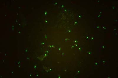 Figura 6 - Controle positivo da Reação de Imunofluorescência Indireta