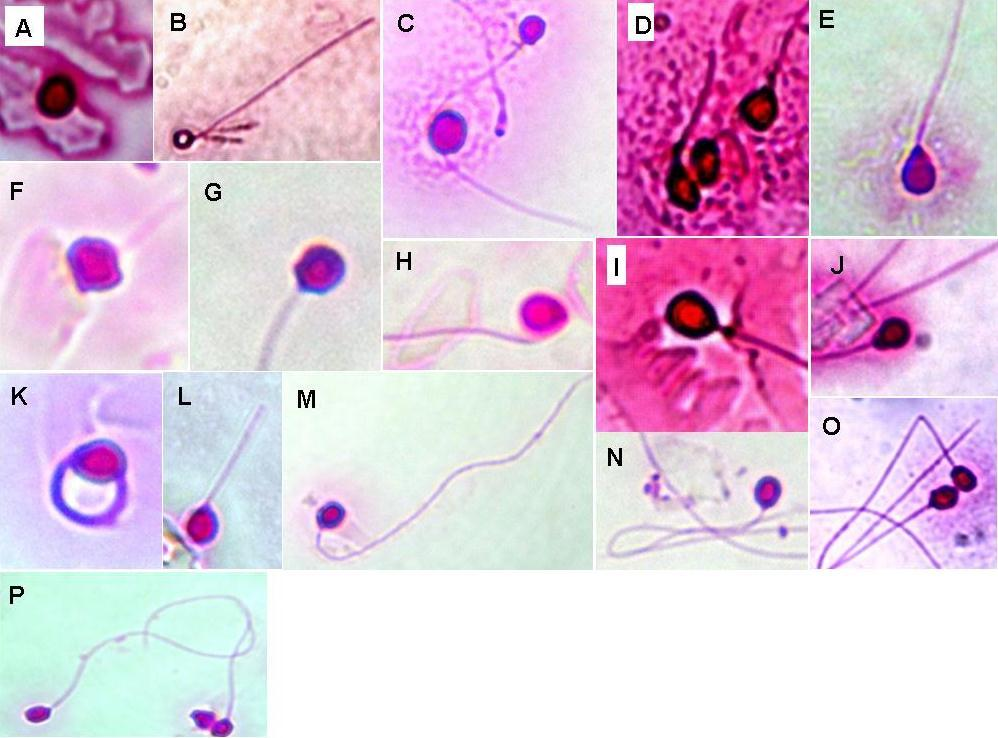 Figura 2. Anormalidades morfológicas espermáticas observadas no sêmen de P. reticulatum, sob microscopia de campo claro (aumento de 1000x), coradas por solução rosa bengala 1%.