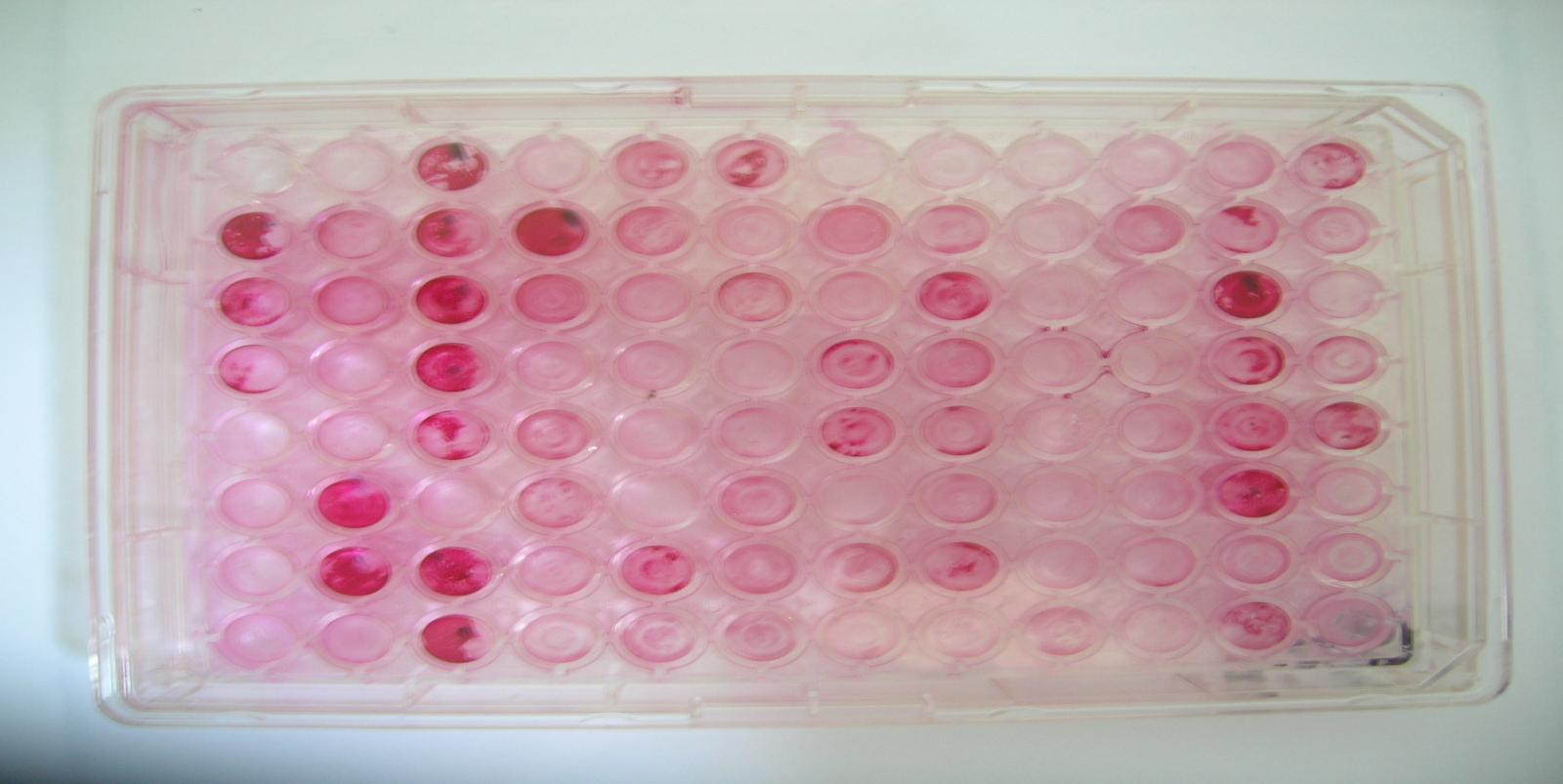 5.3. Fatores de virulência 5.3.1. Produção de slime e genes icaa e icad Foi detectada produção de slime em 82,8% (n= 125) dos Staphylococcus spp.