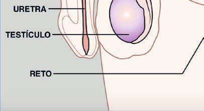 Câncer de próstata O câncer de próstata é o tumor que ocorre na próstata, uma glândula masculina localizada abaixo da bexiga, por onde passa a uretra (canal que conduz a urina desde a bexiga até a