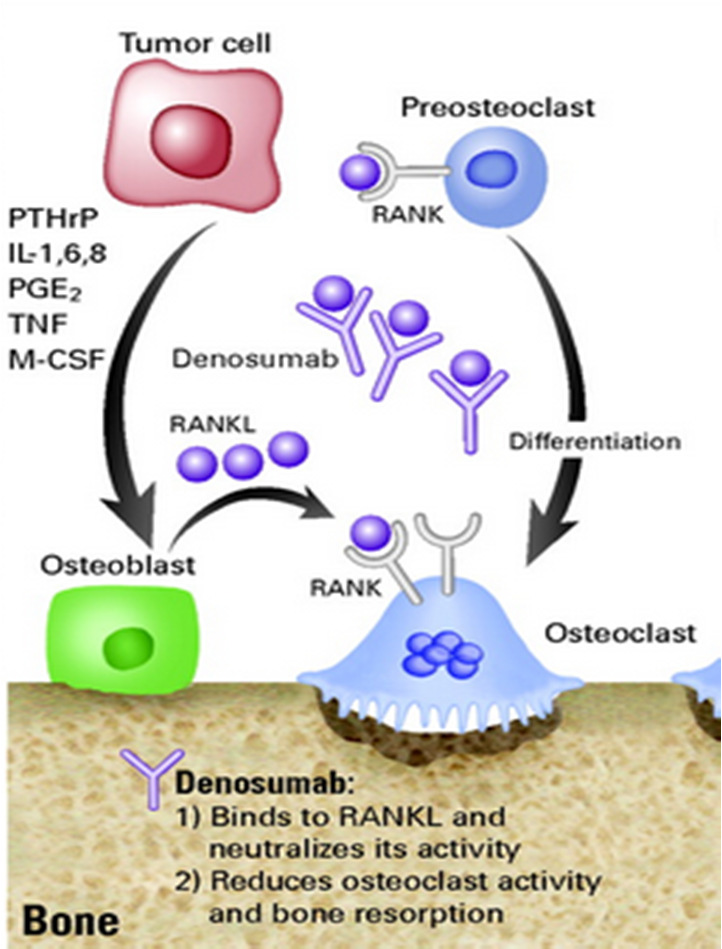 Inibidores da osteólise osteoclástica Denosumabe Anticorpo monoclonal contra o