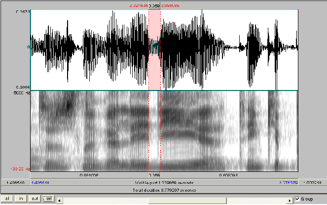 O tap, acusticamente, caracteriza-se no espectrograma por descontinuidade espectral, ou seja, é representado por espaços em branco no espectrograma, pois devido à breve oclusão que ocorre quando a