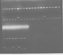 Cromossomo 5 RFLP ATAAC GCGC AAT CACACACA... CTGACTGATATGTA TATTGCGCGTTAGTGTGTGT.