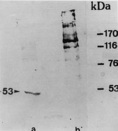 Reatividade do Acmo 56G no Western blot A Figura 2 mostra a banda de 53 kda reconhecida pelo Acmo 56G a partir do AgC de S.