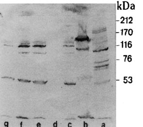 FIGURA 4 - WB. Reatividade do Acmo 56G com células inteiras de diferentes cepas de estreptococos: a) S. mutans CCT 1910, b) S. mutans SP, c) S. pyogenes*, d) S. pyogenes T23, e) S.