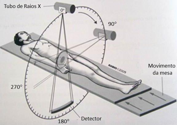 menores são realizadas com o objetivo de diminuir o tempo de exame e com ângulos maiores para diminuir os artefatos de movimento em estudos de regiões específicas do tronco (CARLOS, 2001).