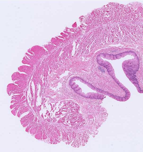 ESÓFAGO - HISTOLOGIA MUSCULARIS PROPRIA Camada circular interna Camada longitudinal externa