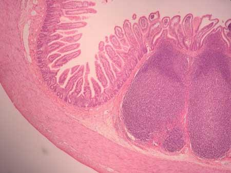 INTESTINO DELGADO - HISTOLOGIA 3 segmentos diferem nas camadas mucosa e submucosa Jejuno