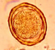 - férteis, menores, mais regulares e com interior mais homogêneo. Quando estão infectantes, possuem a larva L3 em seu interior.