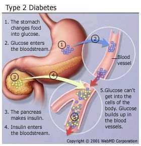 DURAÇÃO DE AÇÃO DAS PREPARAÇÕES DE INSULINA Diabetes Mellitus Diabetes tipo II 90-95% dos pacientes com diabetes Níveis mais baixos de