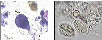 12 1.2 PROTOZOÁRIOS Há vários protozoários parasitas e comensais dos seres vivos, porém apenas a lguns do filo Sarcomastigophora serão abordados, entre eles Giardia lamblia, Entamoeba histolytica,