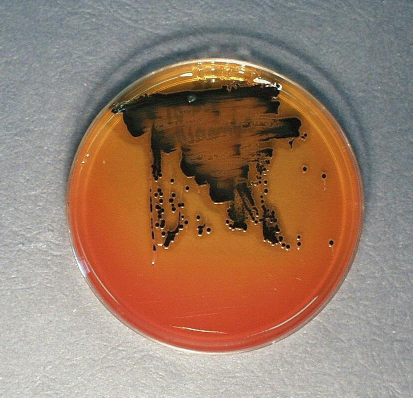 Ágar SS (Salmonella/Shigella) Salmonella sp Lactose - (Transparente) Produção de H 2 S (Com centro negro) Meio Seletivo e diferencial: verde brilhante,