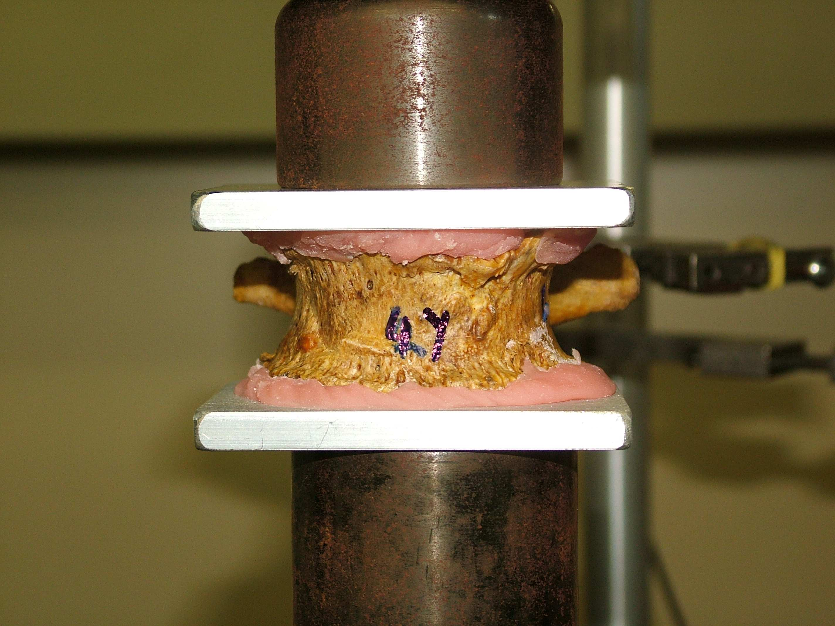 144 Figura 40 - Acoplamento do corpo vertebral na máquina de ensaio h) a partir dos dados obtidos, foi analisada a relação entre os parâmetros descritos nos Objetivos Primário e Secundário. 5.2.