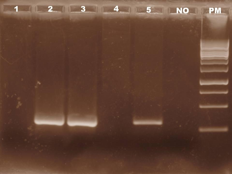 - Oligonucleotídeos 4558/ 4559 (P) Na tentativa de padronização da reação da PCR para os oligonucleotídeos 4558 e 4559 (internos aos 4558/ 2733), foram, assim como para os demais, realizados vários