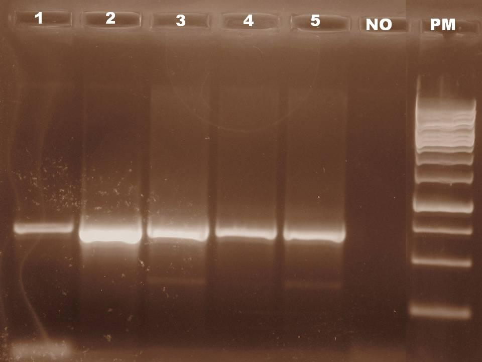 - Oligonucleotídeos HepF300/ Hep900 Na tentativa de padronização da reação da PCR para os oligonucleotídeos HepF300 e Hep900, foram realizados testes de concentração de reagentes e gradiente de