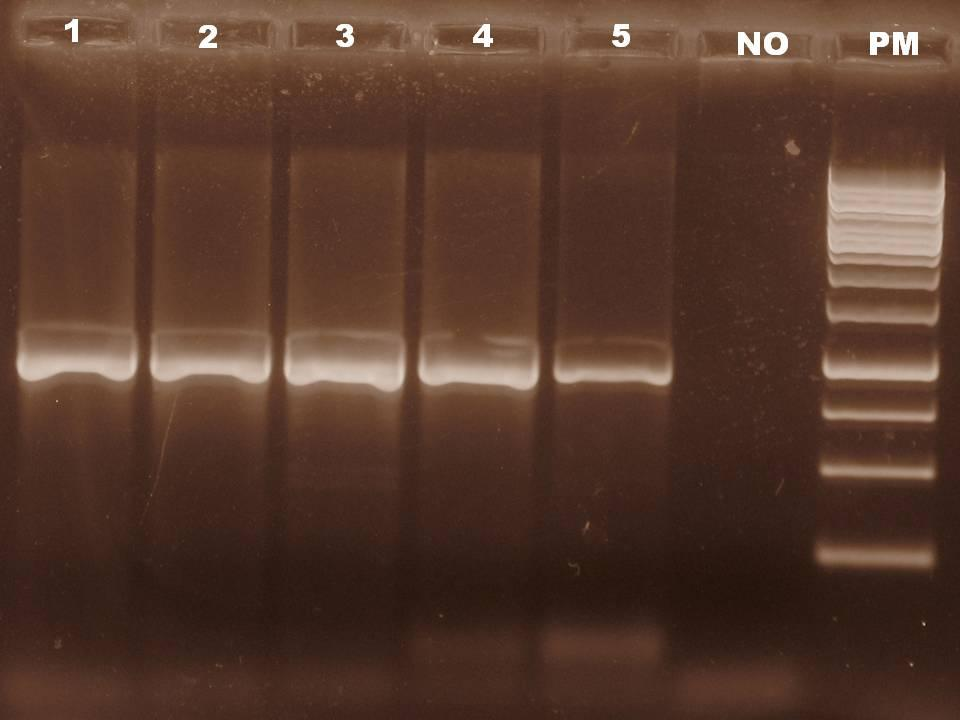 - Oligonucleotídeos HEMO1/ HEMO2 Para a padronização da reação da PCR usando os oligonucleotídeos HEMO1 e HEMO2, também foram realizados testes de concentração de reagentes e gradiente de temperatura