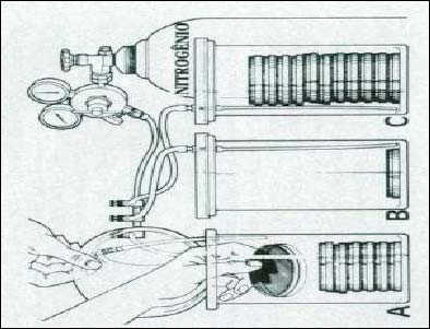 Atmosfera de Incubação - Substituição de uma atmosfera normal por uma mistura apropriada de gases (bomba de vácuo) - Utilização de geradores de gases comerciais.