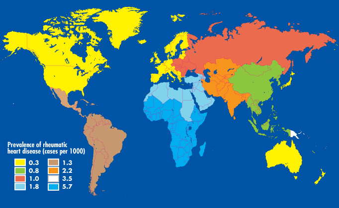 SOBRE Prevalência de Febre Reumática!"#$%&'()*%+,#+-. INTERNAÇÕES Febre Reumática Aguda Brasil: 6.349 intern/ano Nordeste: 2.