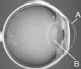 QUESTÃO 17 (1,0 ponto) DESCREVA as características da imagem formada pelo cristalino (lente convergente), no fundo dos olhos (retina) de um olho humano saudável.