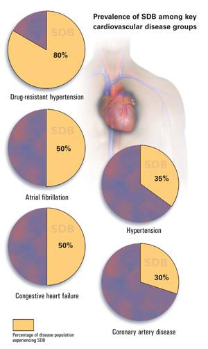 SAOS e Doença Cardiovascular Hipertensão Resistente Fibrilhação Auricular