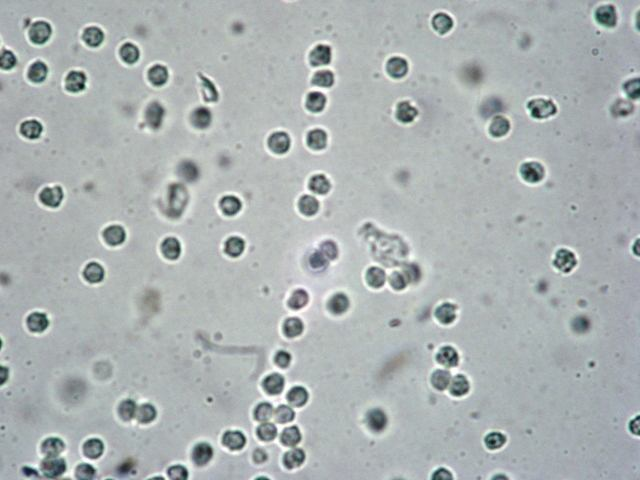 81 grande número de bactérias e células da bexiga, pode-se tratar de cistite (FERREIRA NETO et al., 1977).