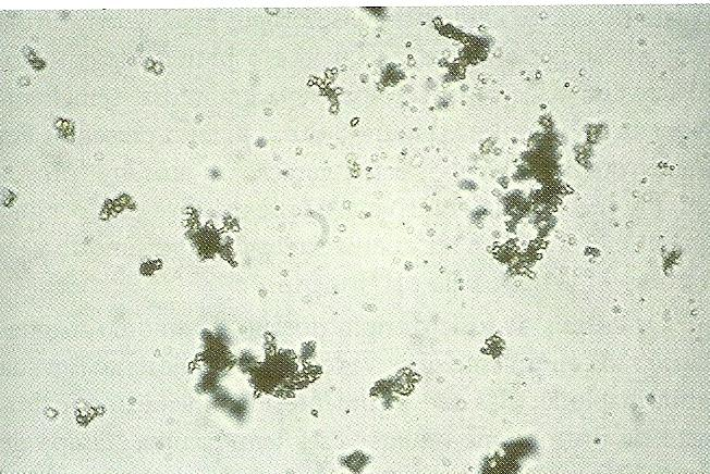 36 Figura 38 Cilindro céreo corado por KOVA (x400), (Strasinger, 2009). Cristais Urinários Os cristais, muito encontrados na urina, raramente tem significado clínico.