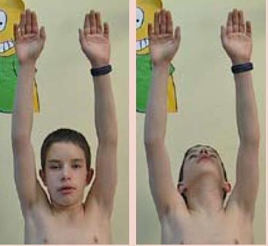 Figura Manobras de screening (as marcadas em negrito são diferentes das do adulto) Toque as pontas de cada um dos seus dedos com o polegar O que está sendo avaliado Coordenação motora, concentração e