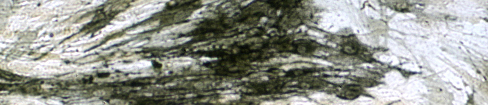 - - 32 Figura 6: Fotomicrografia de células derivadas do paciente 3 cultivadas por 21 dias sem meio DAG, controle, não sendo evidenciando a presença de fosfatase alcalina.
