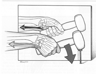 MÚSCULOS DESVIO RADIAL Extensor radial longo e curto do carpo Abdutor longo do polegar Extensor longo e curto do polegar Flexor