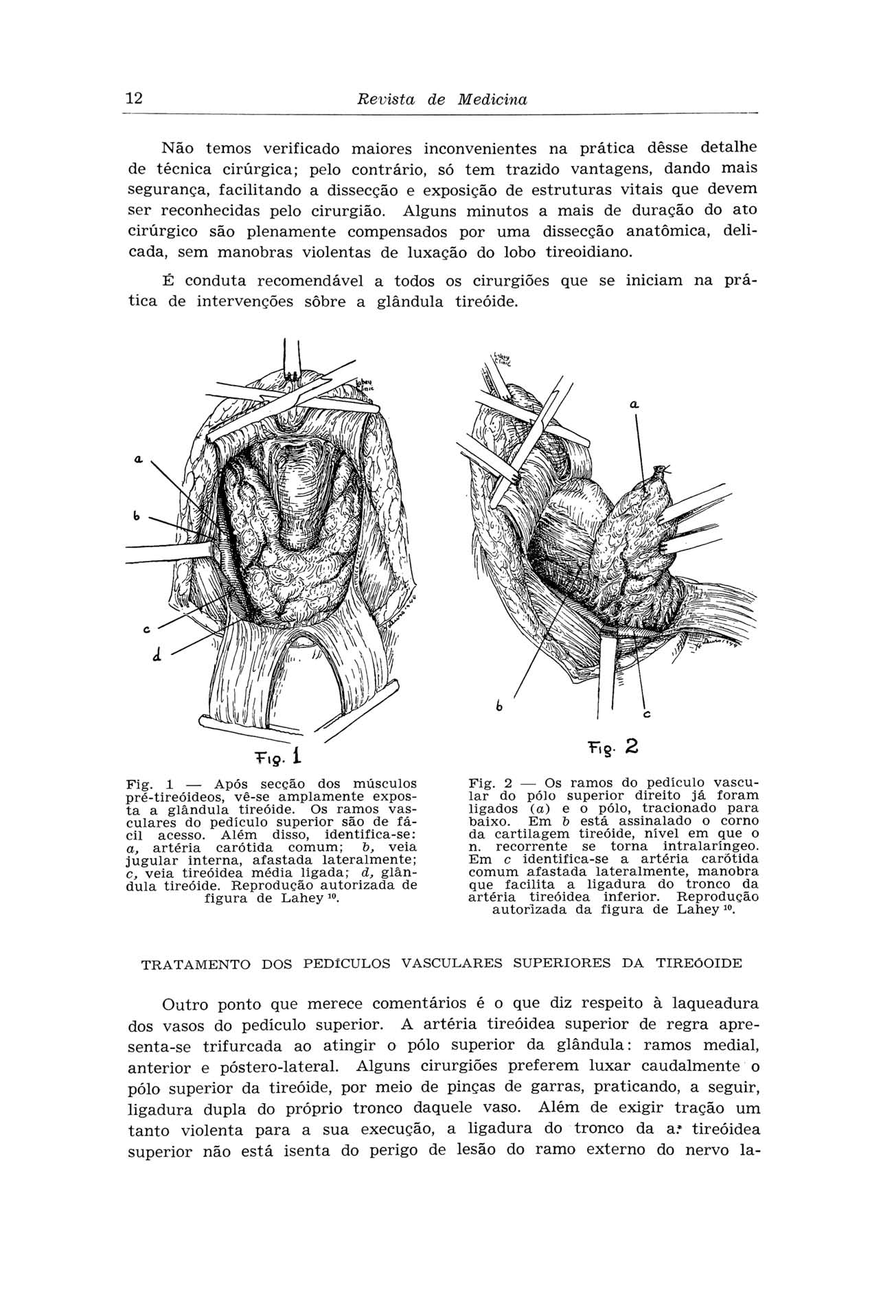 12 Revista de Medicina Não temos verificado maiores inconvenientes na prática desse detalhe de técnica cirúrgica; pelo contrário, só tem trazido vantagens, dando mais segurança, facilitando a