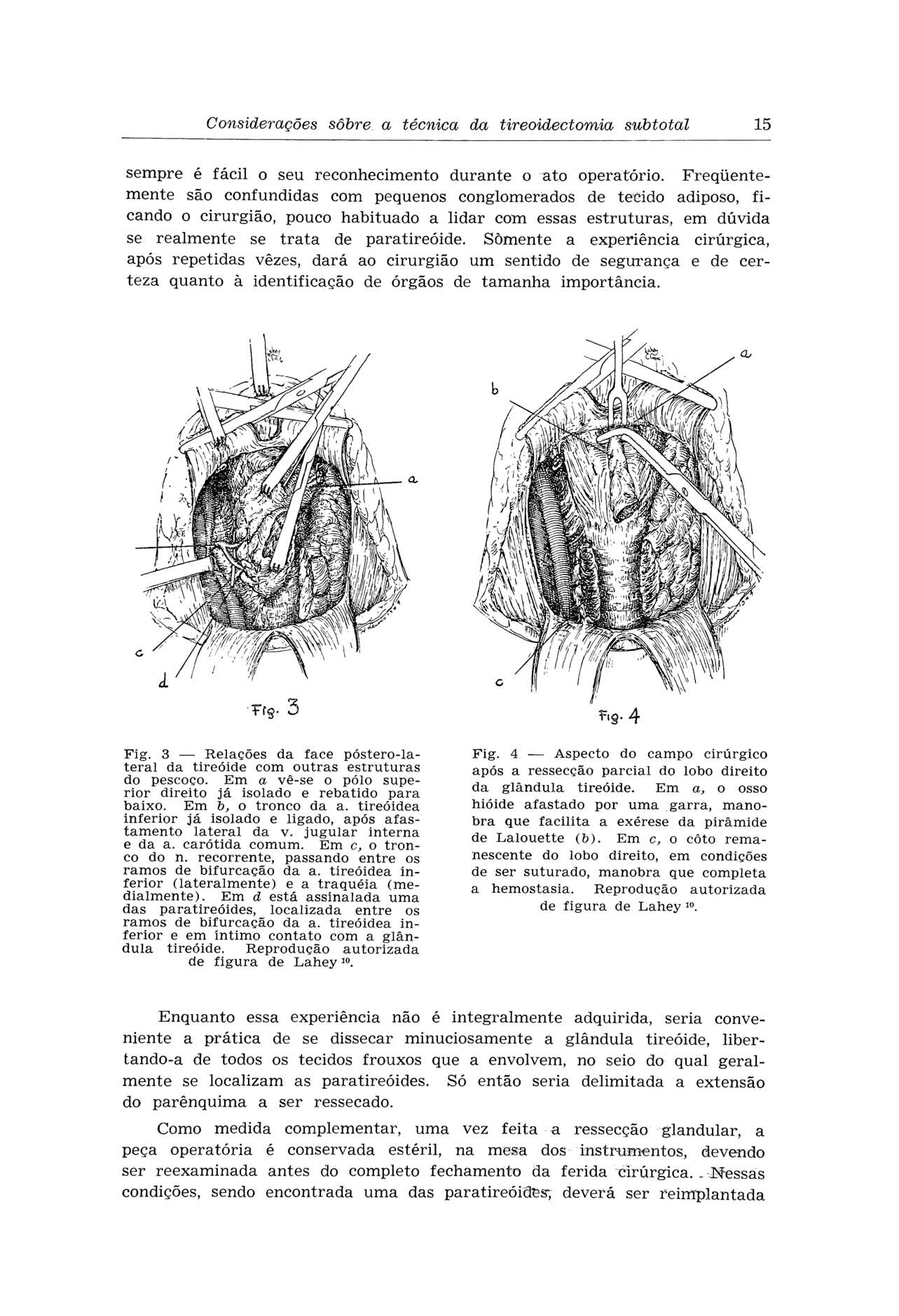 Considerações sobre a técnica da tireoidectomia subtotal 15 sempre é fácil o seu reconhecimento durante o ato operatório.