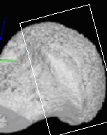 9 Lima et al: Microtomografia Computadorizada 3D microestrutura que não seja homogênea ao longo das seções, os resultados podem conduzir a uma falsa conclusão.