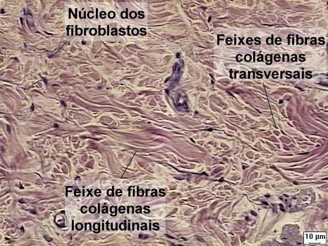 tecido conjuntivo denso nãomodelado Fibras não possuem